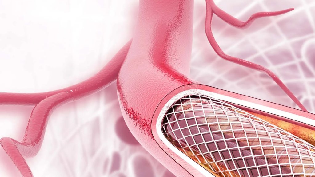 Custom PTFE Tubing: The Quirky Life Saver You Didn’t Know You Needed
